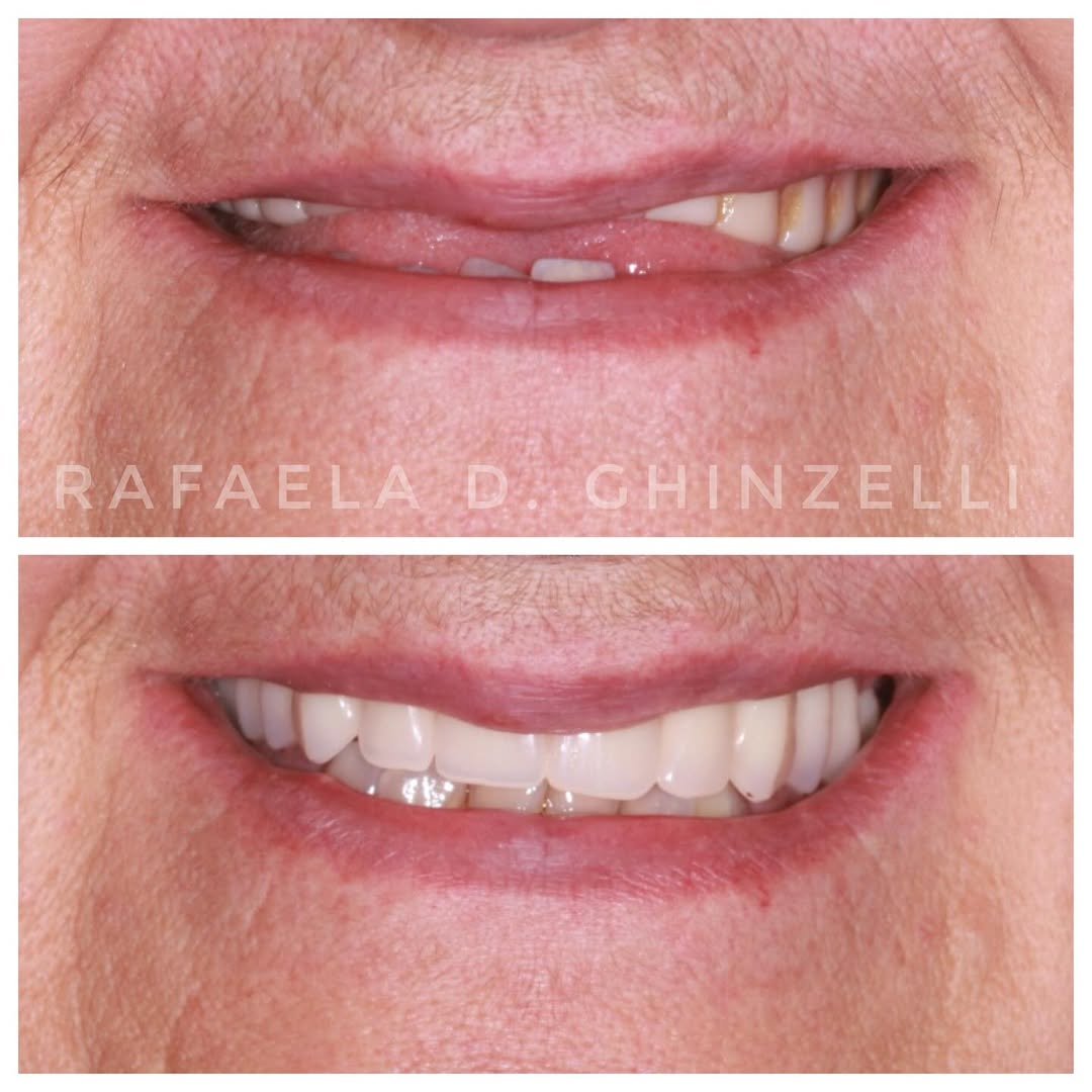 Rafaela Dal Ponte Ghinzelli